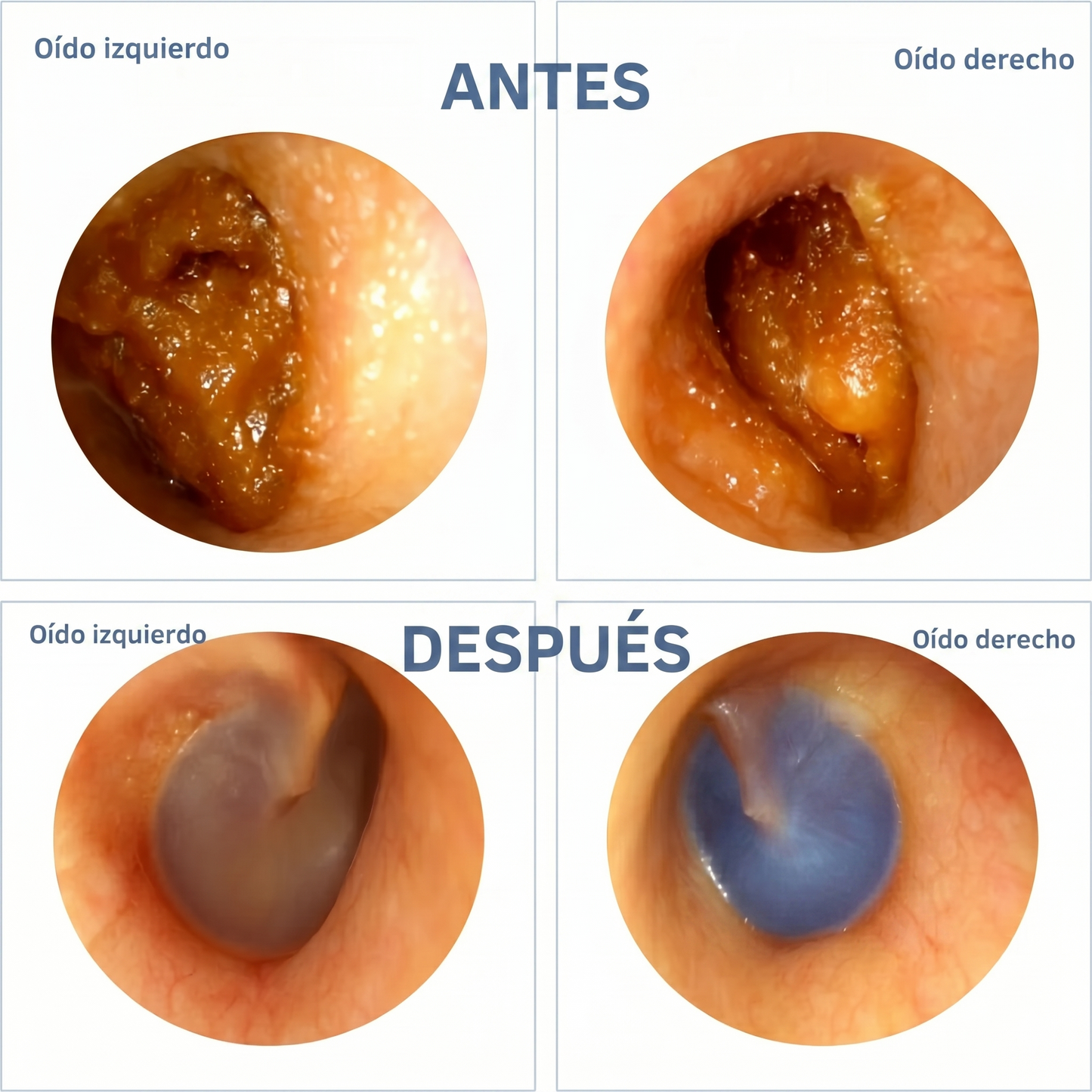 Limpiador de oídos | Tu esencia vital