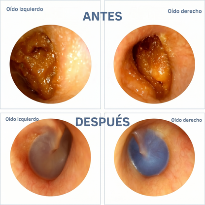Limpiador de oídos | Tu esencia vital